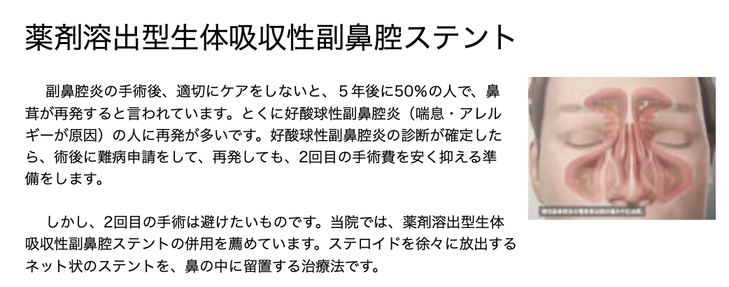 ステント